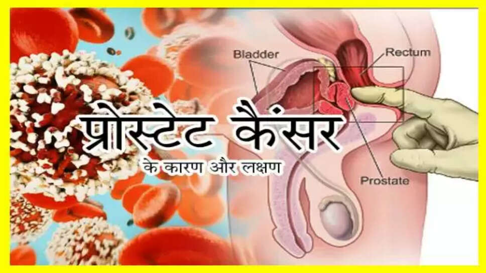 Protest Cancer