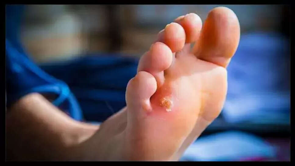 leg