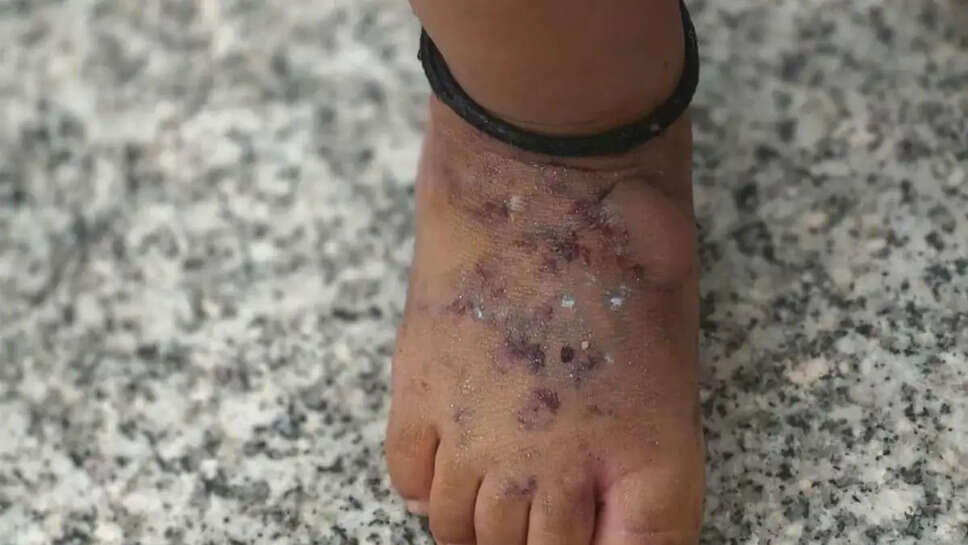 ew