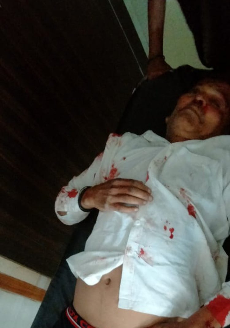 तिलमापुर में नकाबपोश बदमाशों ने स्कूटी सवार को मारी गोली, पुलिस जांच में जुटी...